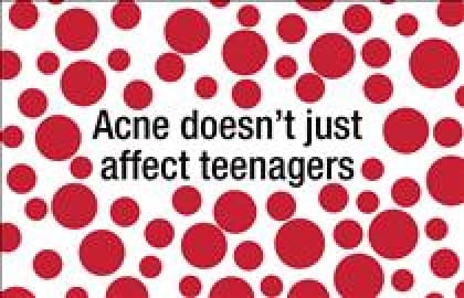 akne doesn't just affect teenagers